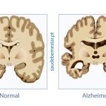 livro sobre doença Alzheimer